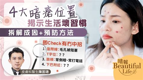 大暗瘡|【暗瘡位置】不同代表什麼？中醫教如何處理及預防